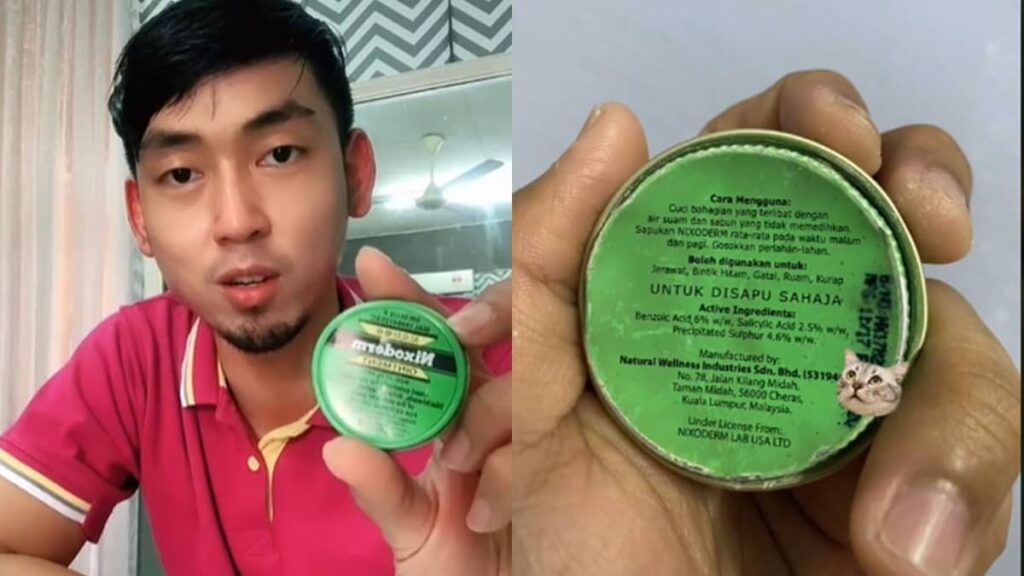 Pasal Viral Dekat TikTok, Ramai Yang Cari Krim Jerawat Ni  Santai Sini