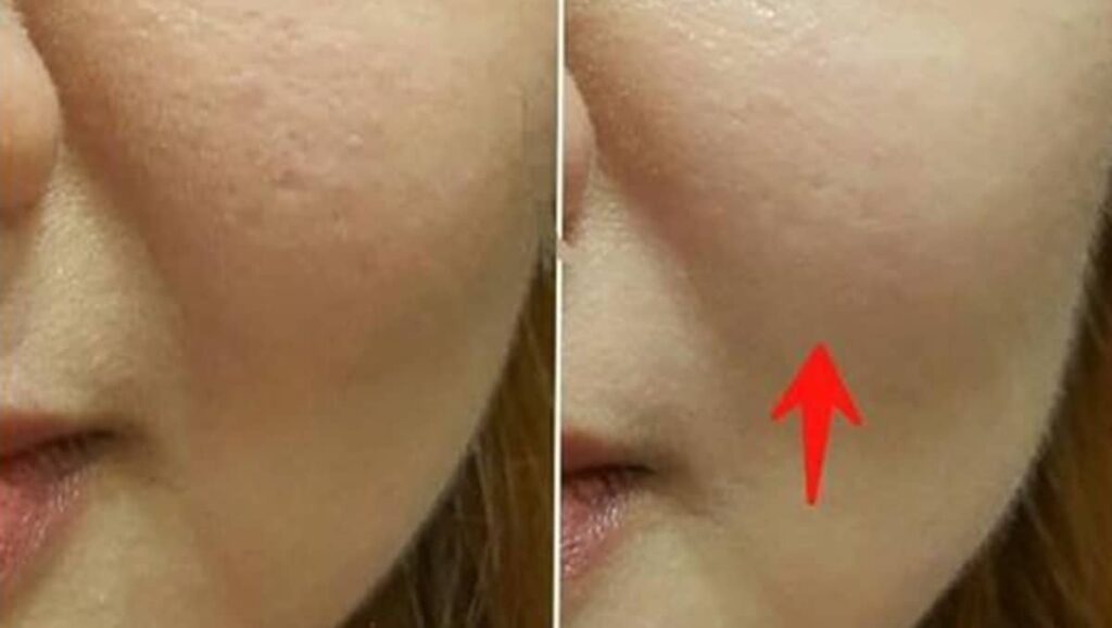Supplement Kolagen Serbuk Vs Tablet: Mana Lebih Berkesan?